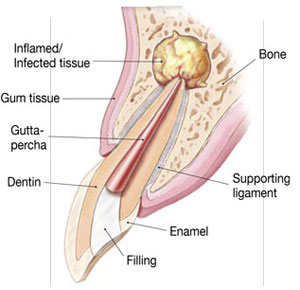 tooth