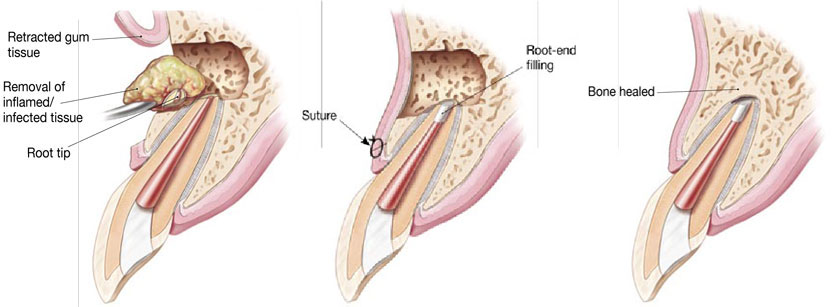 tooth